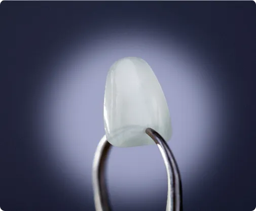 Dental Veneers at Northern New Mexico Dental Center