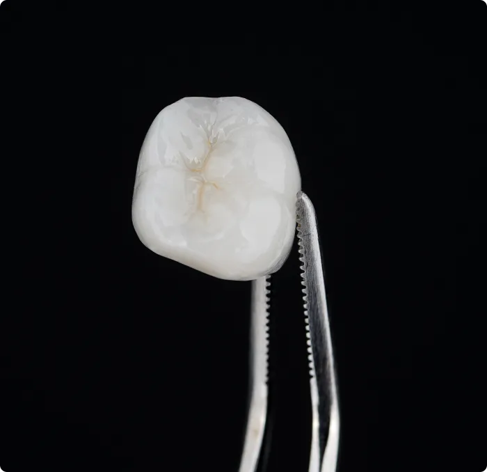 Dental Crowns at Northern New Mexico Dental Center