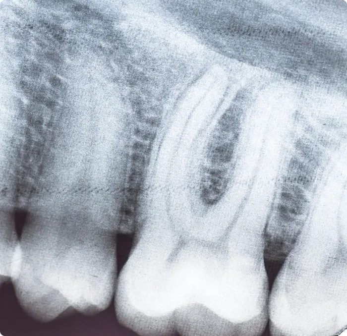 Digital X-Rays at Northern New Mexico Dental Center