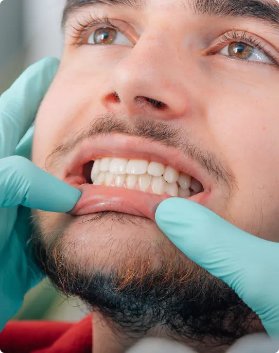 Gum Disease Treatment at Northern New Mexico Dental Center