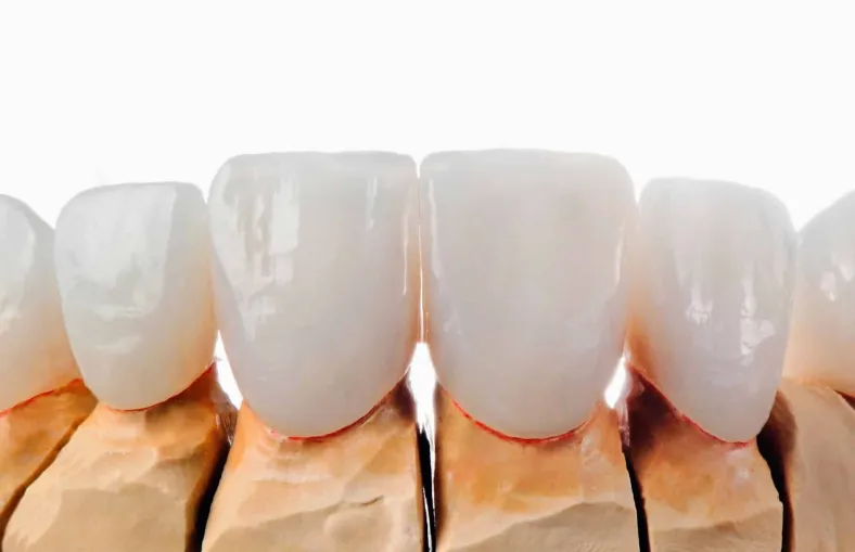 Metal-Free Dentistry at Northern New Mexico Dental Center